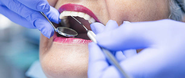Best Emergency Root Canal Treatment in Hartford, SD